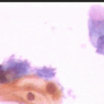 Εικόνα 2  στις 4.11.2004